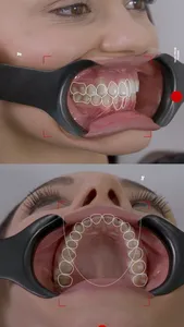 Dental Shooting v2 screenshot 3