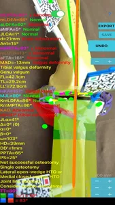 CorectiAR screenshot 0