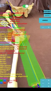 CorectiAR screenshot 6