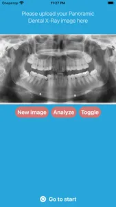 DentalScanner screenshot 1