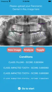 DentalScanner screenshot 2