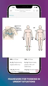 MedSurg Notes: Nurse Pkt Guide screenshot 2