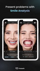 Preteeth AI Pro screenshot 1