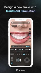 Preteeth AI Pro screenshot 2