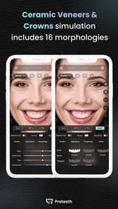 Preteeth AI Pro screenshot 3