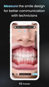 Preteeth AI Pro screenshot 5