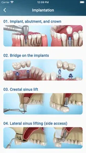 Dental 3D Illustrations screenshot 2