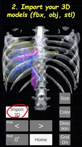 AR Puncture: Medical AR Viewer screenshot 1