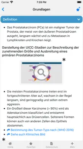 Prostatakarzinom onkowissen screenshot 1