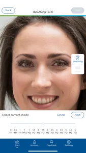 Ivoclar Smile screenshot 2