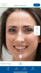 Ivoclar Smile screenshot 3