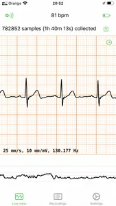 ECG EKG Viewer for Polar H10 screenshot 0