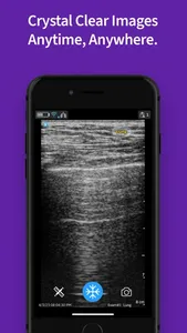 Vscan Air VET Ultrasound screenshot 2