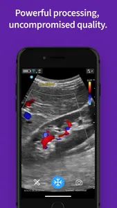 Vscan Air VET Ultrasound screenshot 4