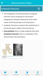 Orthopedic Signs & Angles screenshot 6