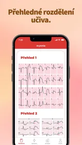 EKG: Snadno a rychle screenshot 4