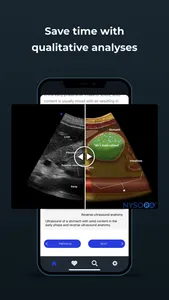 Point of Care Ultrasound screenshot 4