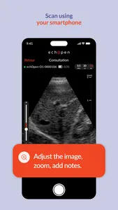 echOpen ON screenshot 1