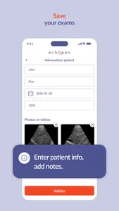 echOpen ON screenshot 2