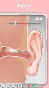 Ear Cleaning Master screenshot 4