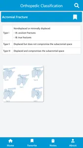 Fractures Classification App screenshot 3