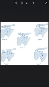 Fractures Classification App screenshot 4