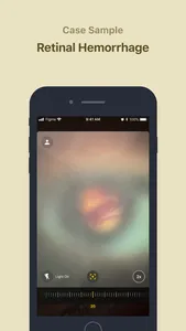 Ophthalmoscope SEC screenshot 1