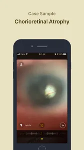 Ophthalmoscope SEC screenshot 2