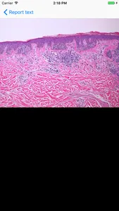 iDermpath screenshot 2