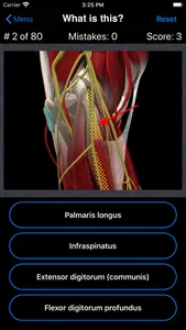 Anatomy Shoulder Quiz screenshot 1