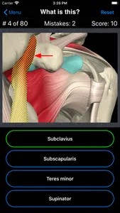 Anatomy Shoulder Quiz screenshot 2