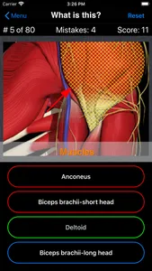 Anatomy Shoulder Quiz screenshot 3