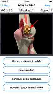 Anatomy Shoulder Quiz screenshot 4