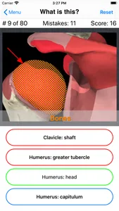 Anatomy Shoulder Quiz screenshot 5