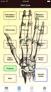 Mobile Coder Hand & Wrist screenshot 0