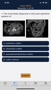 CTisus iQuiz screenshot 1