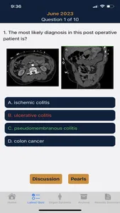 CTisus iQuiz screenshot 2