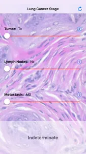 Lung Cancer Stage screenshot 0