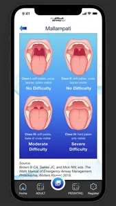 The Difficult Airway App screenshot 7