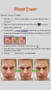 Pimple Eraser LITE screenshot 4