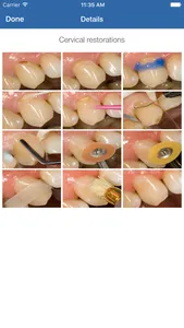 Dental Composite screenshot 1