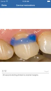 Dental Composite screenshot 2