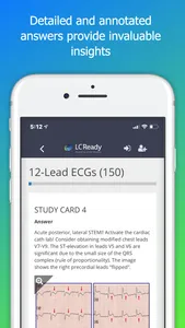 12 Lead ECG Challenge screenshot 4