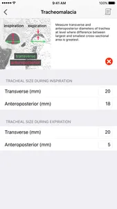 Clinical Imaging Calculator screenshot 2