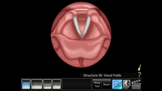 Vocal Folds ID screenshot 0