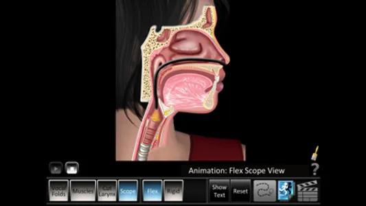 Vocal Folds ID screenshot 3