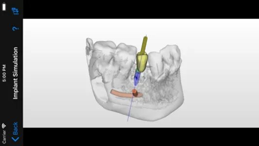 Dental CT View screenshot 2