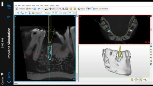 Dental CT View screenshot 3