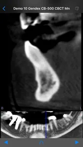 Dental CT View screenshot 5