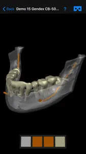 Dental CT View screenshot 8